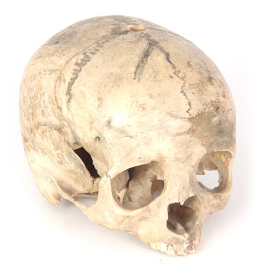 Lot 363 - A LATE 19TH CENTURY HUMAN SKULL missing lower...